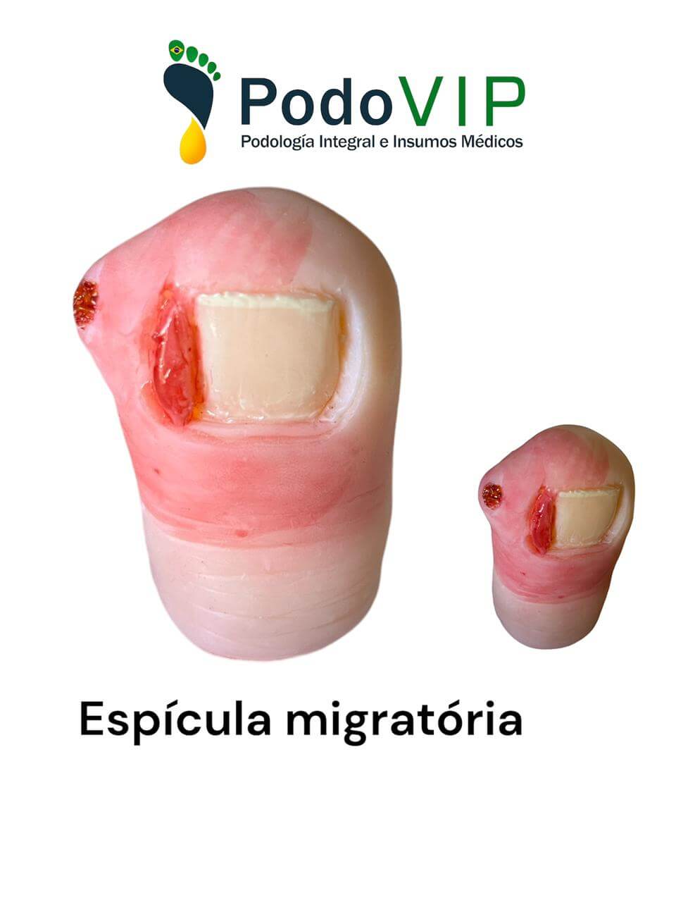 Espicula Migratoria