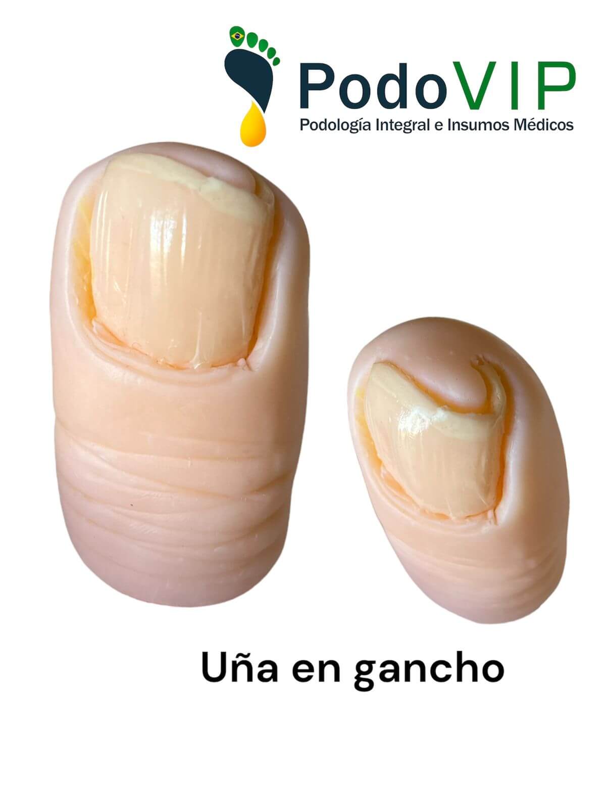 Uña en Gancho